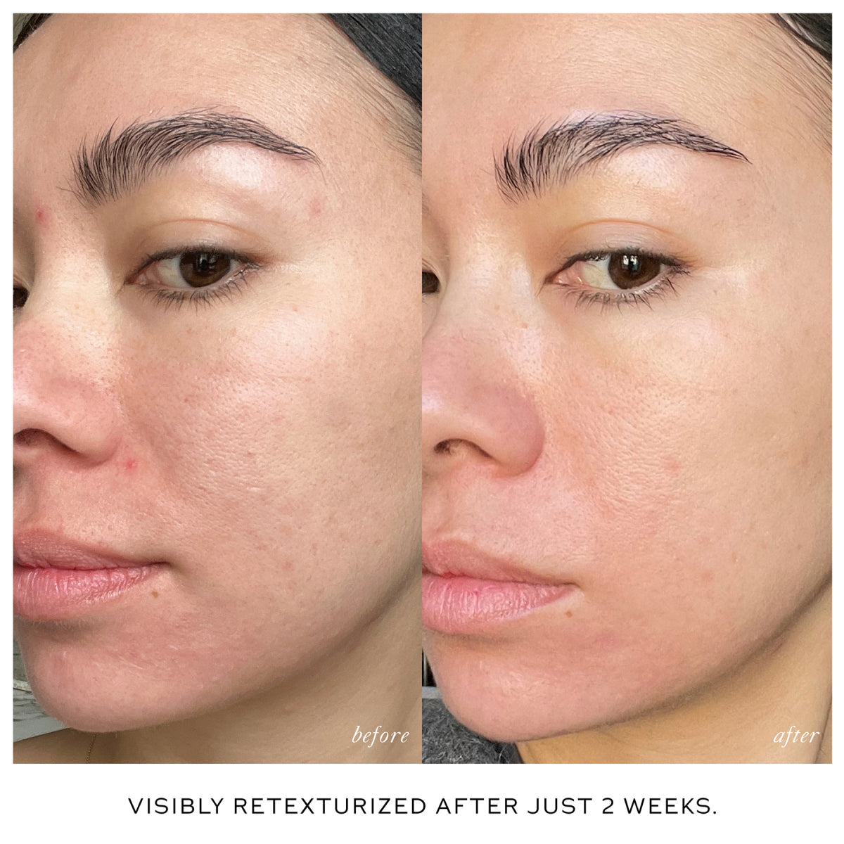 Skin Activator Rollerball