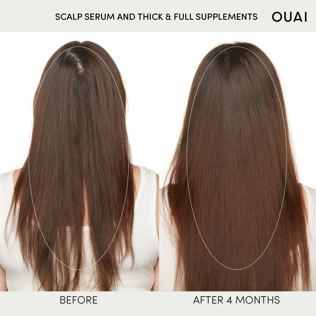 Scalp Serum