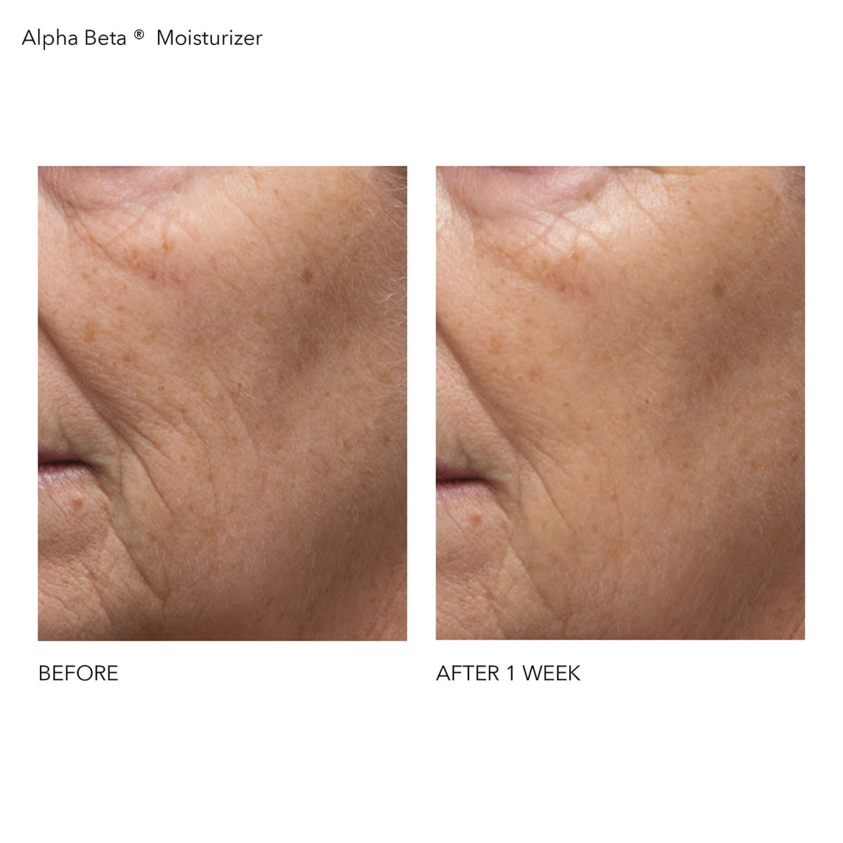 Alpha Beta Daily Moisturizer