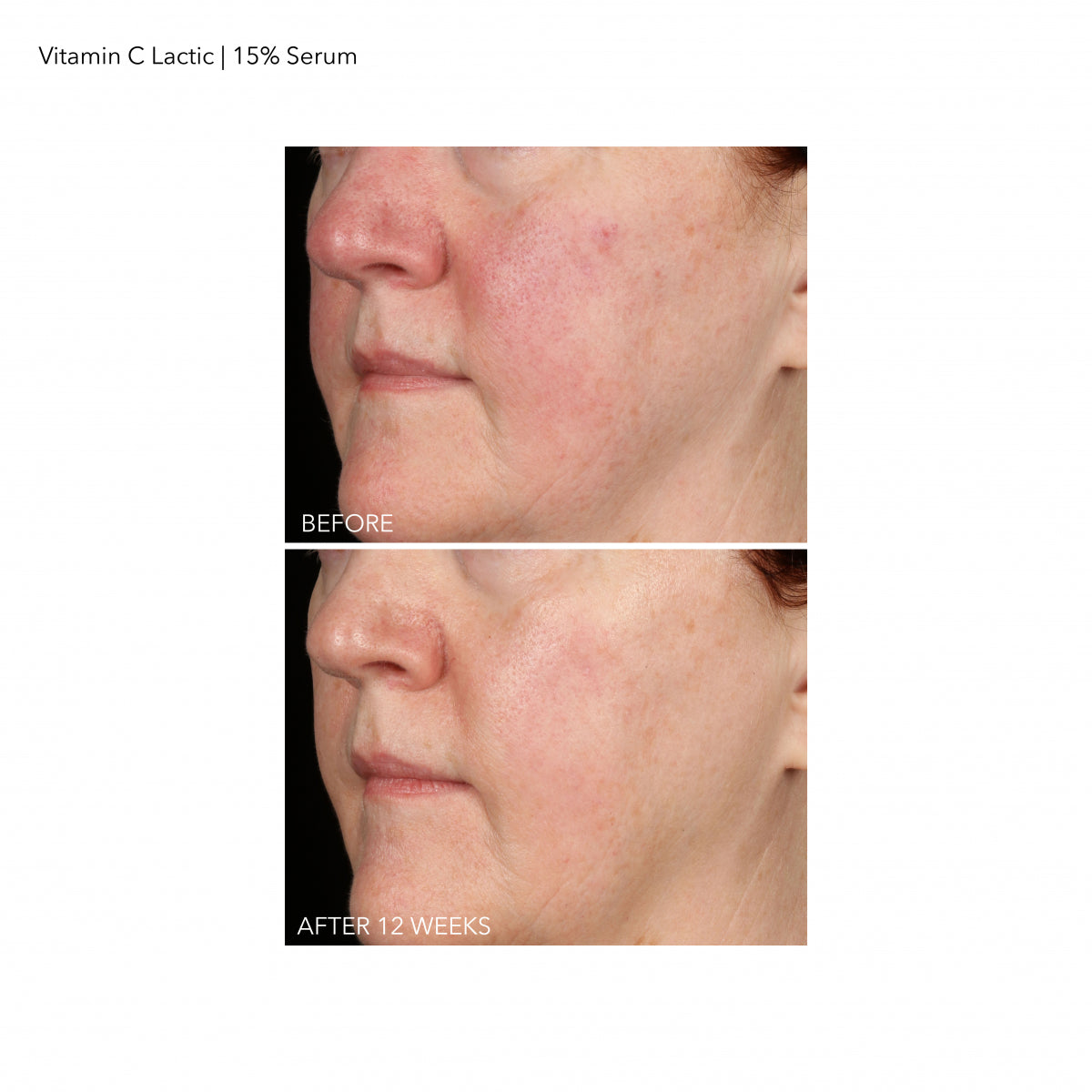 Vitamin C Lactic Firm and Bright Serum