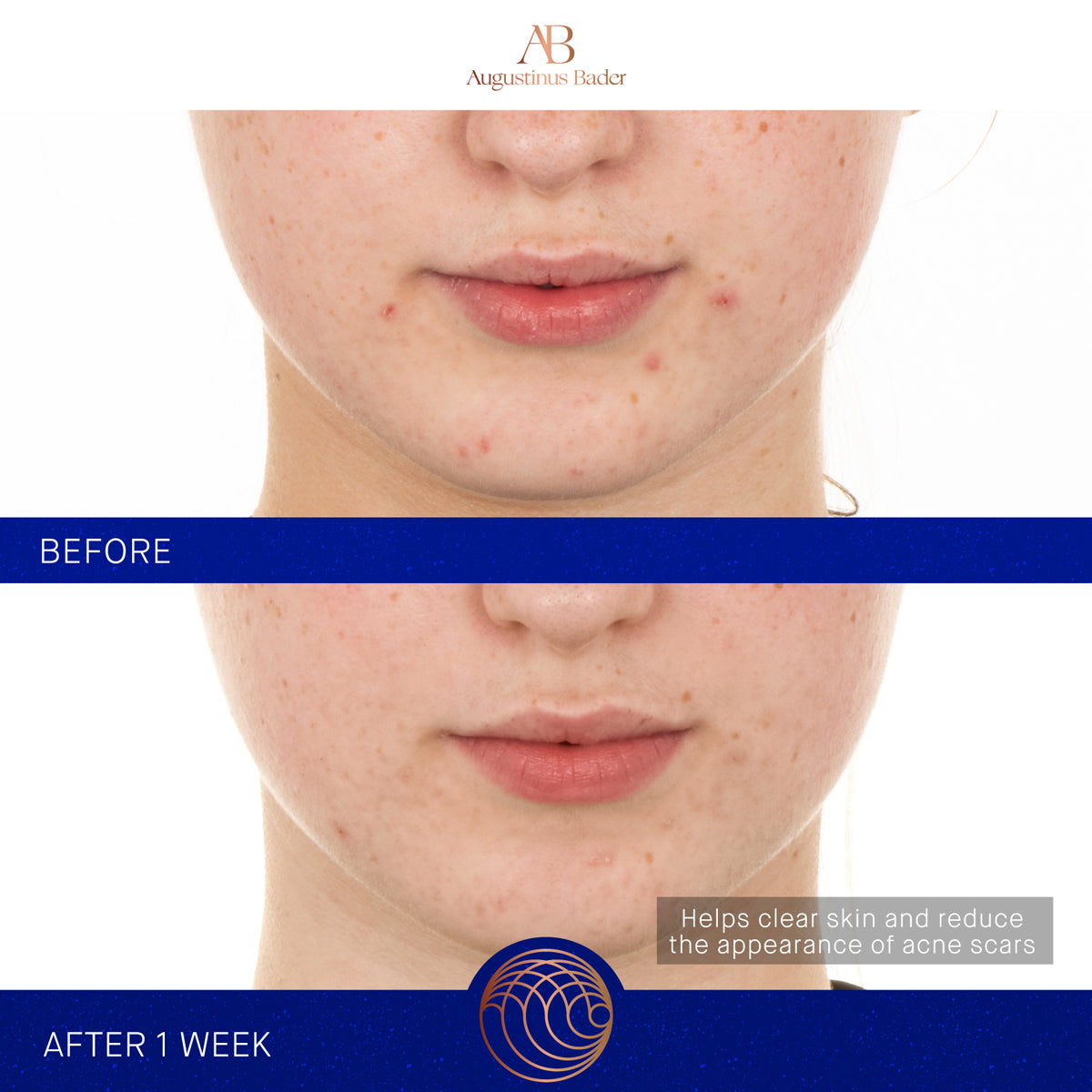 The Retinol Serum, 30ml