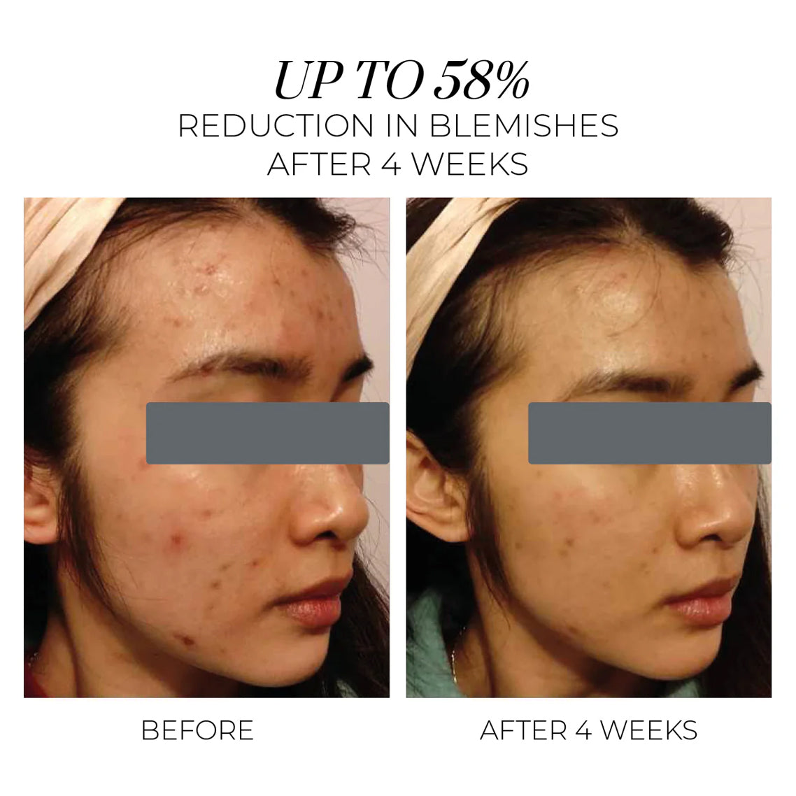 Violet Water Hydra Gel Clarifying Daily Moisturizer