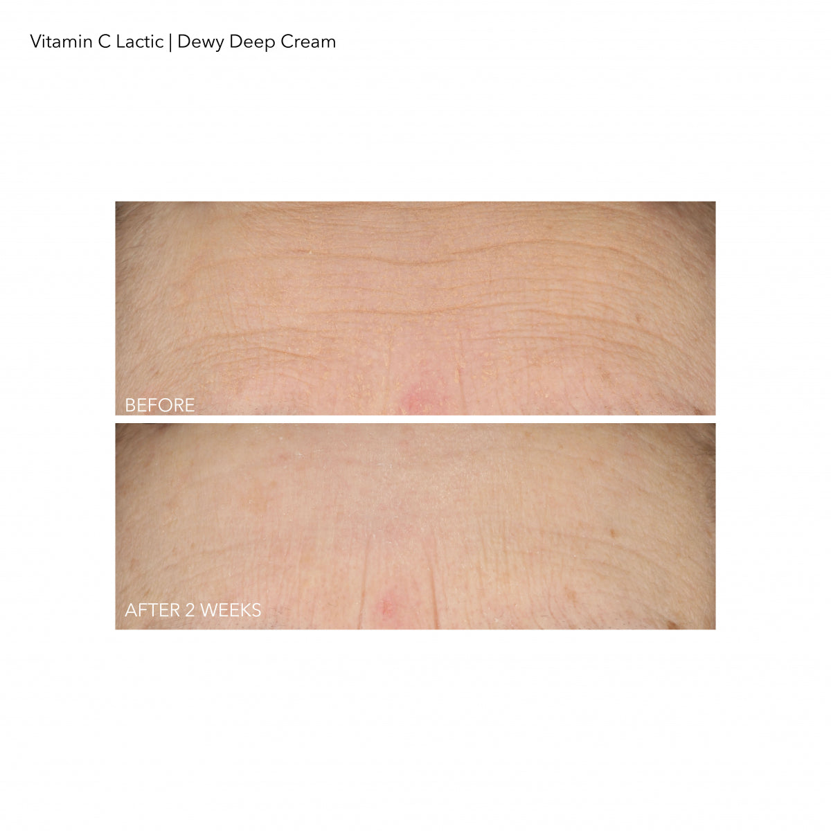 Vitamin C Lactic Dewy Deep Cream