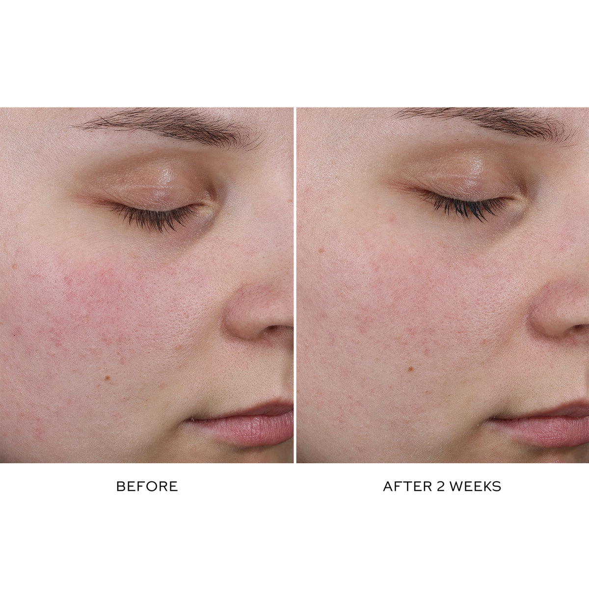 Pore Refining Complex