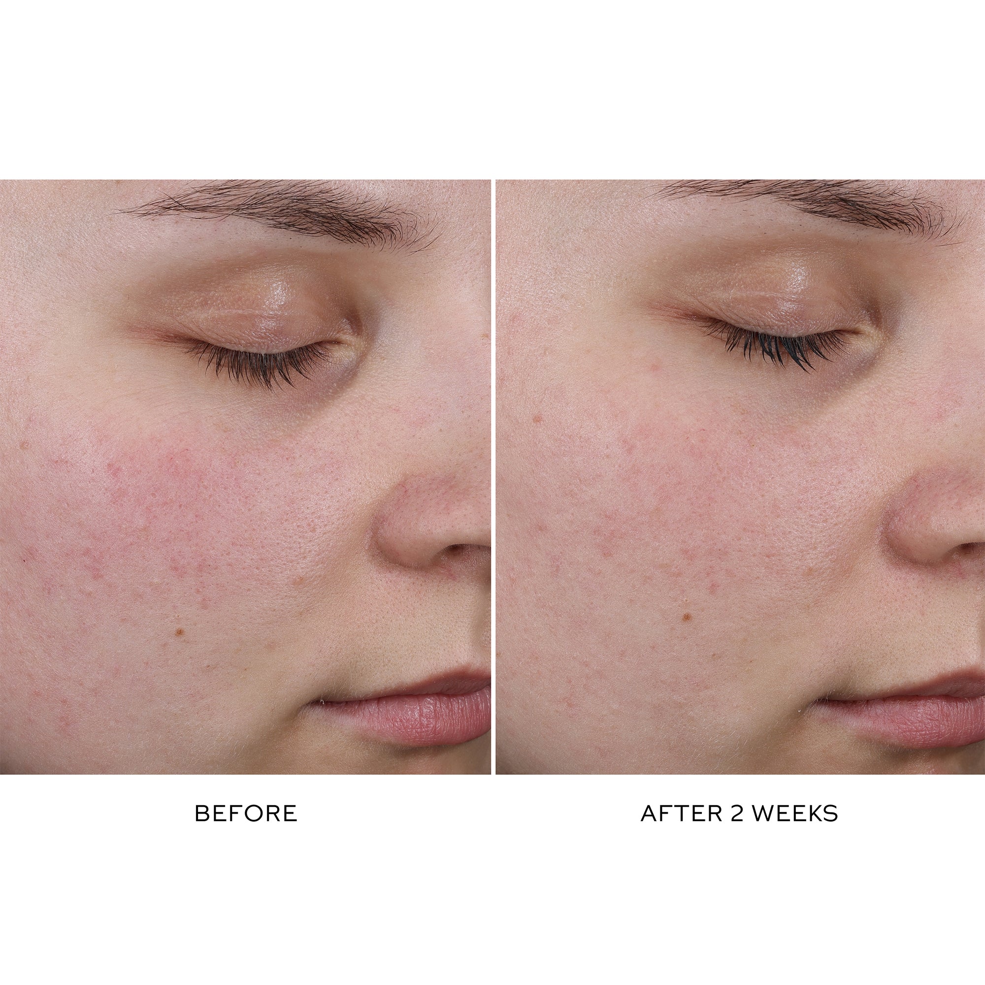 Pore Refining Complex