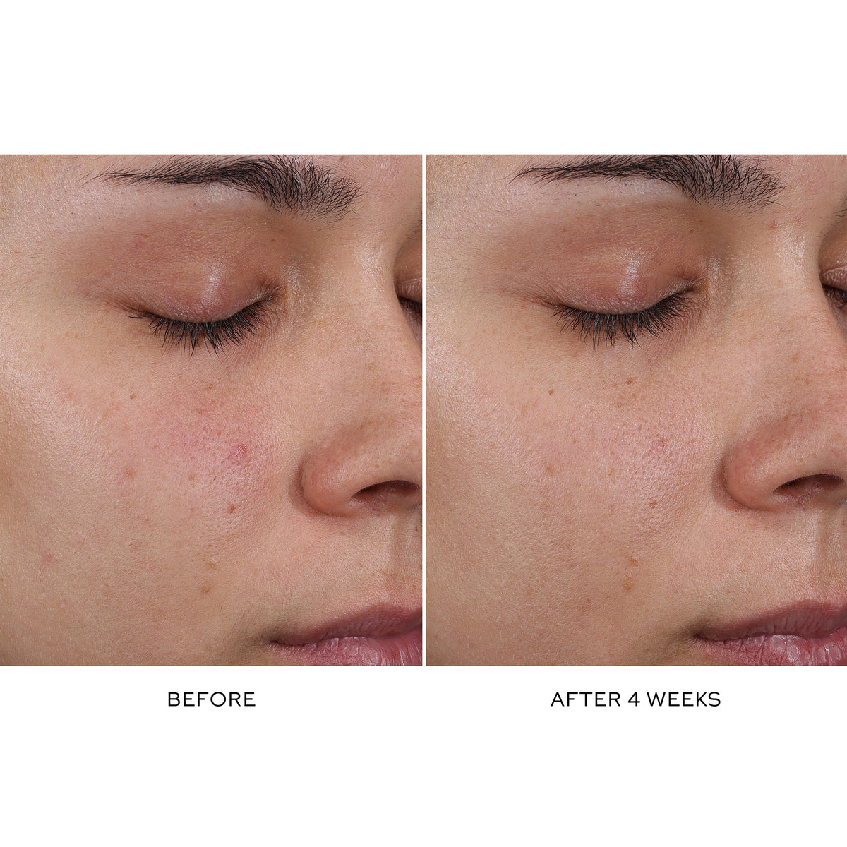 Pore Refining Complex